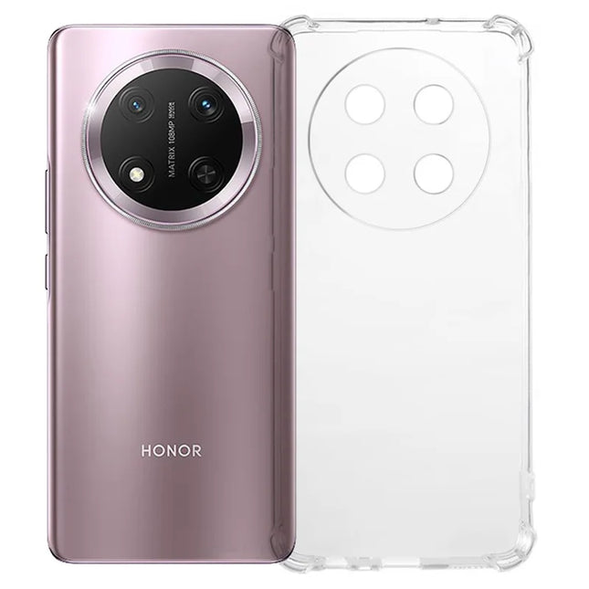 For Honor Magic7 Lite 5G / X9c 5G / X60 Pro 5G Clear Phone Case KALEBOL KLB-TPU001 1.5mm TPU Shockproof Phone Cover - Transparent