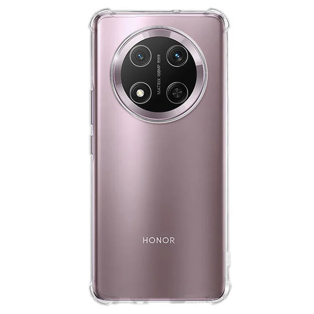 For Honor Magic7 Lite 5G / X9c 5G / X60 Pro 5G Clear Phone Case KALEBOL KLB-TPU001 1.5mm TPU Shockproof Phone Cover