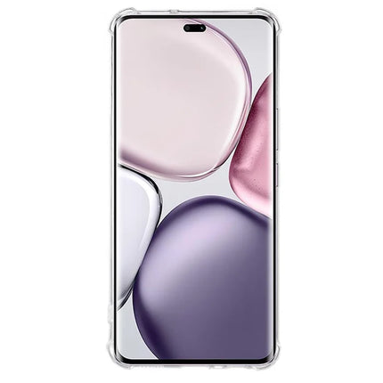 For Honor Magic7 Lite 5G / X9c 5G / X60 Pro 5G Clear Phone Case KALEBOL KLB-TPU001 1.5mm TPU Shockproof Phone Cover