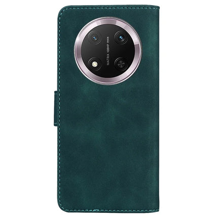 For Honor Magic7 Lite 5G / X9c 5G / X60 Pro 5G Case Solid Color Leather Wallet Phone Cover