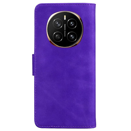 For Honor Magic7 5G Case Solid Color Leather Wallet Phone Cover