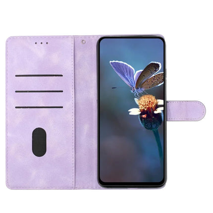 For Samsung Galaxy A36 5G Case Butterfly Flower Pattern Skin-Touch Leather Phone Cover