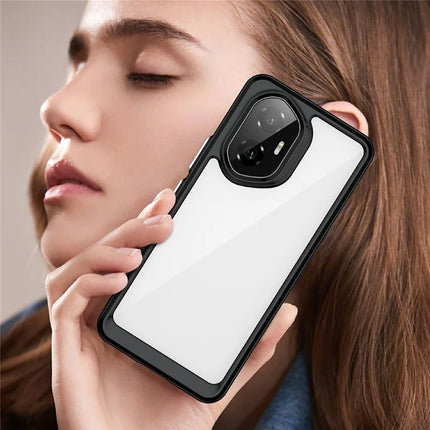 For Honor 300 Case TPU + Acrylic Protective Clear Phone Cover