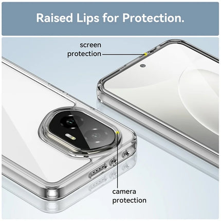 For Honor 300 Case TPU + Acrylic Protective Clear Phone Cover