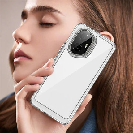 For Honor 300 Case TPU + Acrylic Protective Clear Phone Cover