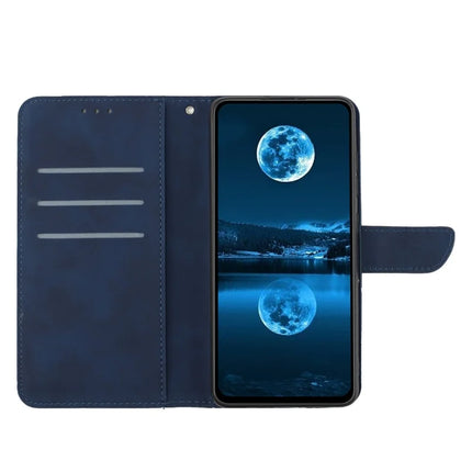 For OnePlus 13 Case Skin Touch Lines Imprinted PU Leather Flip Phone Cover